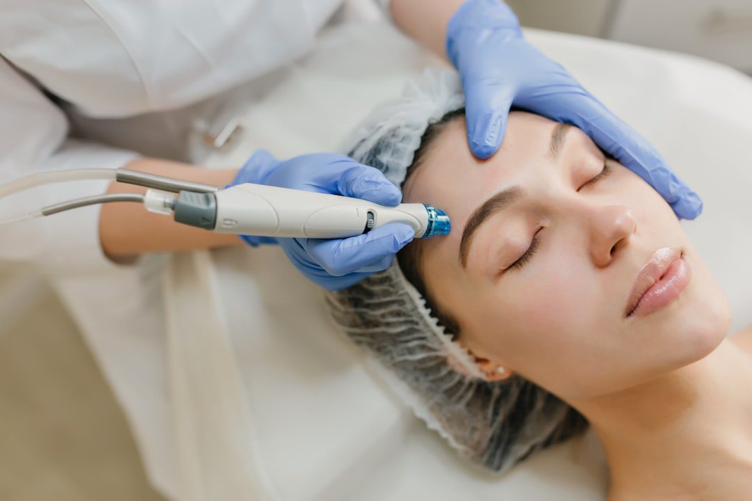 Aesthetic skin treatment consultation illustrating choices between traditional and RF microneedling